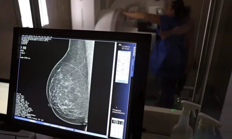 Planos de saúde terão que cobrir mamografia digital sem limite de idade a partir de outubro